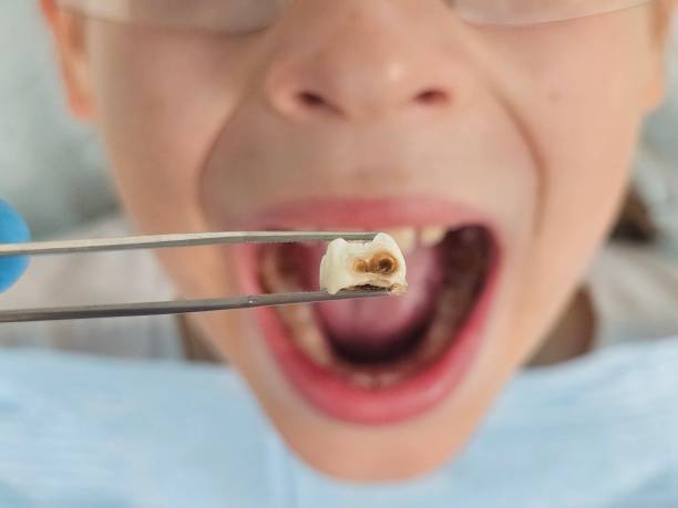 Best Emergency Orthodontic Repairs in Penngrove, CA